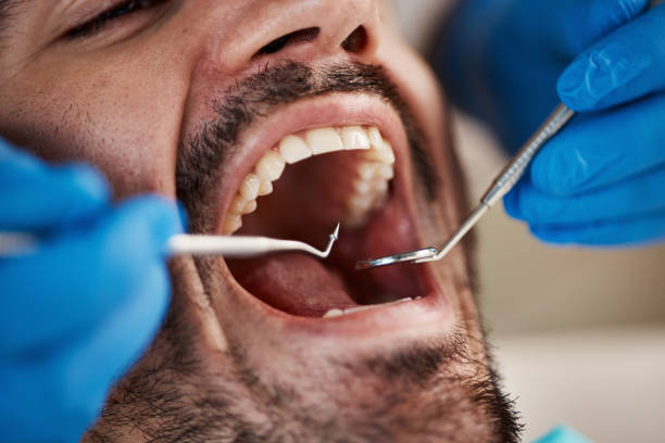 Best Emergency Dental Surgery in Rossmoor, CA